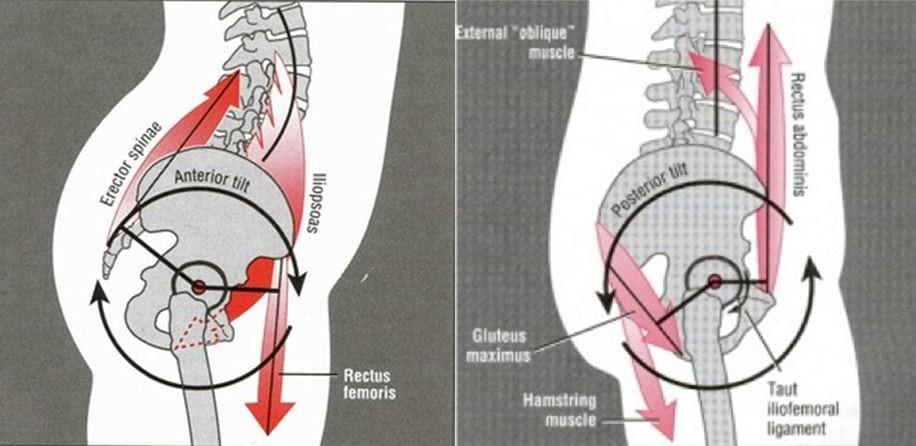 Anterior tilt illustration