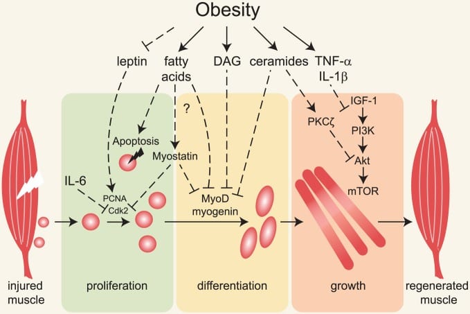 recovery capacity obesity