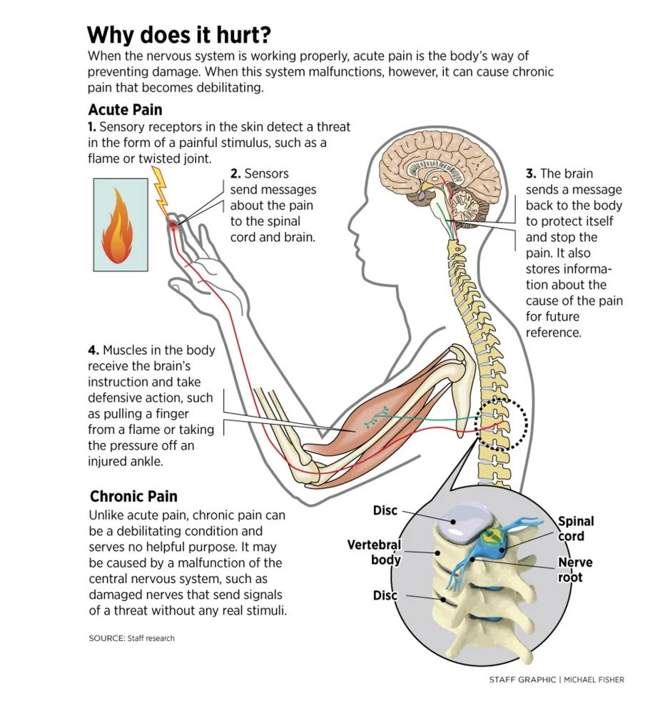 pain science