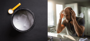 Creatine and Hair Loss